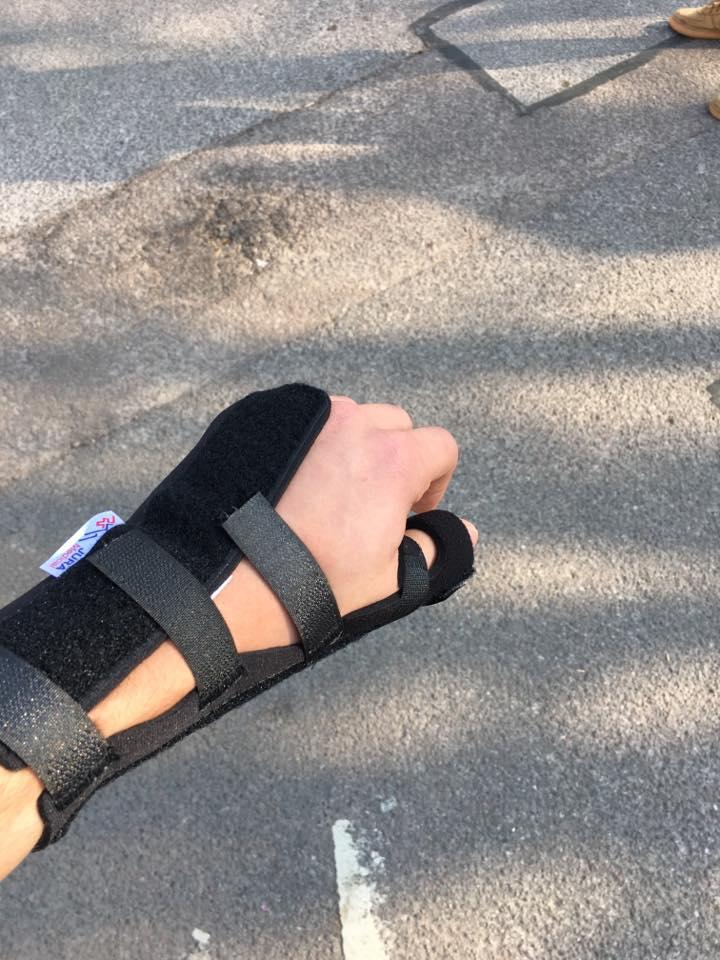t_maddock's tweet photo. Jaden broke his thumb at Slimbridge football training Thursday- fell on it !!! Only him- hospital said he might need an op (hopefully not) - so unlucky with injuries. https://t.co/r4GLsmC9cQ