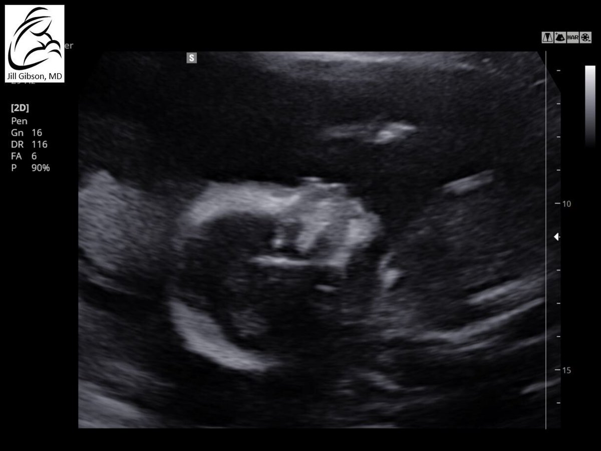 _ChelseaMaeBae's tweet photo. I can’t wait to meet my son😫❤️ #KhalilJR https://t.co/HokW7d4fVL