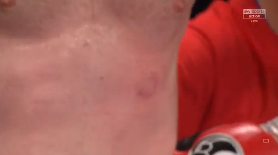 BITTEN! 

Kash Ali just tackled David Price and BIT him! 😱

Price wins by DQ

📲 Watch now live on Sky Sports Action or follow here:  skysports.tv/s6iDor