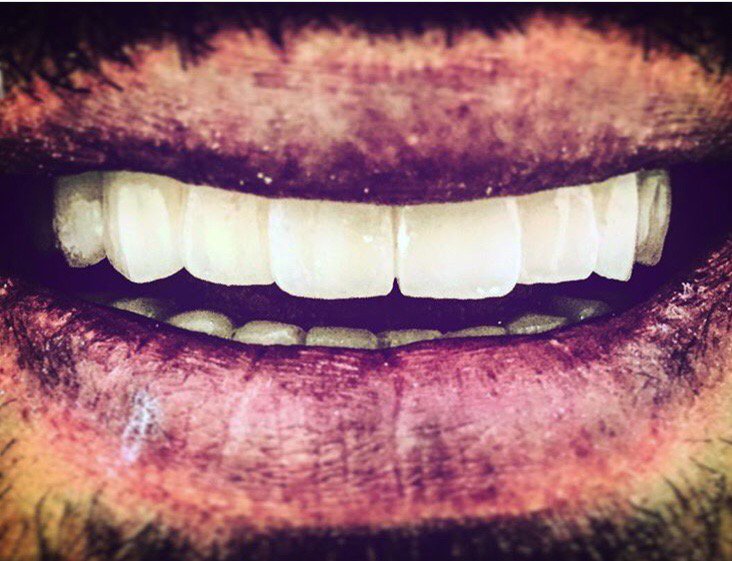 Dr.Hesna Huseyni (@hesnahuseyni) on Twitter photo 