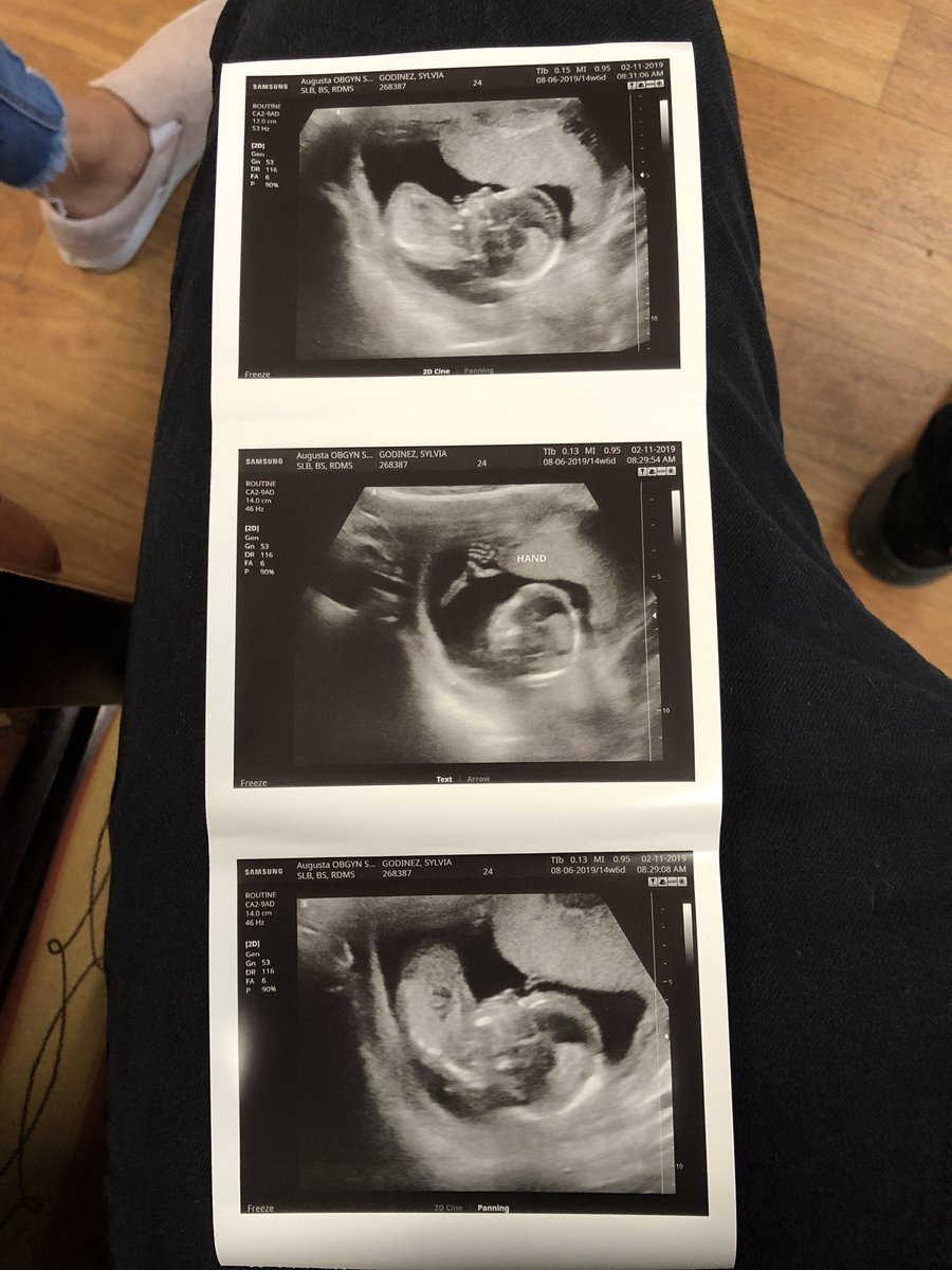 SavvyZay's tweet photo. It’s been so hard keeping you a secret for 5 months. You will be the best birthday gift i could ever receive ♥️ #dueinaugust https://t.co/uGK6VjNfVs