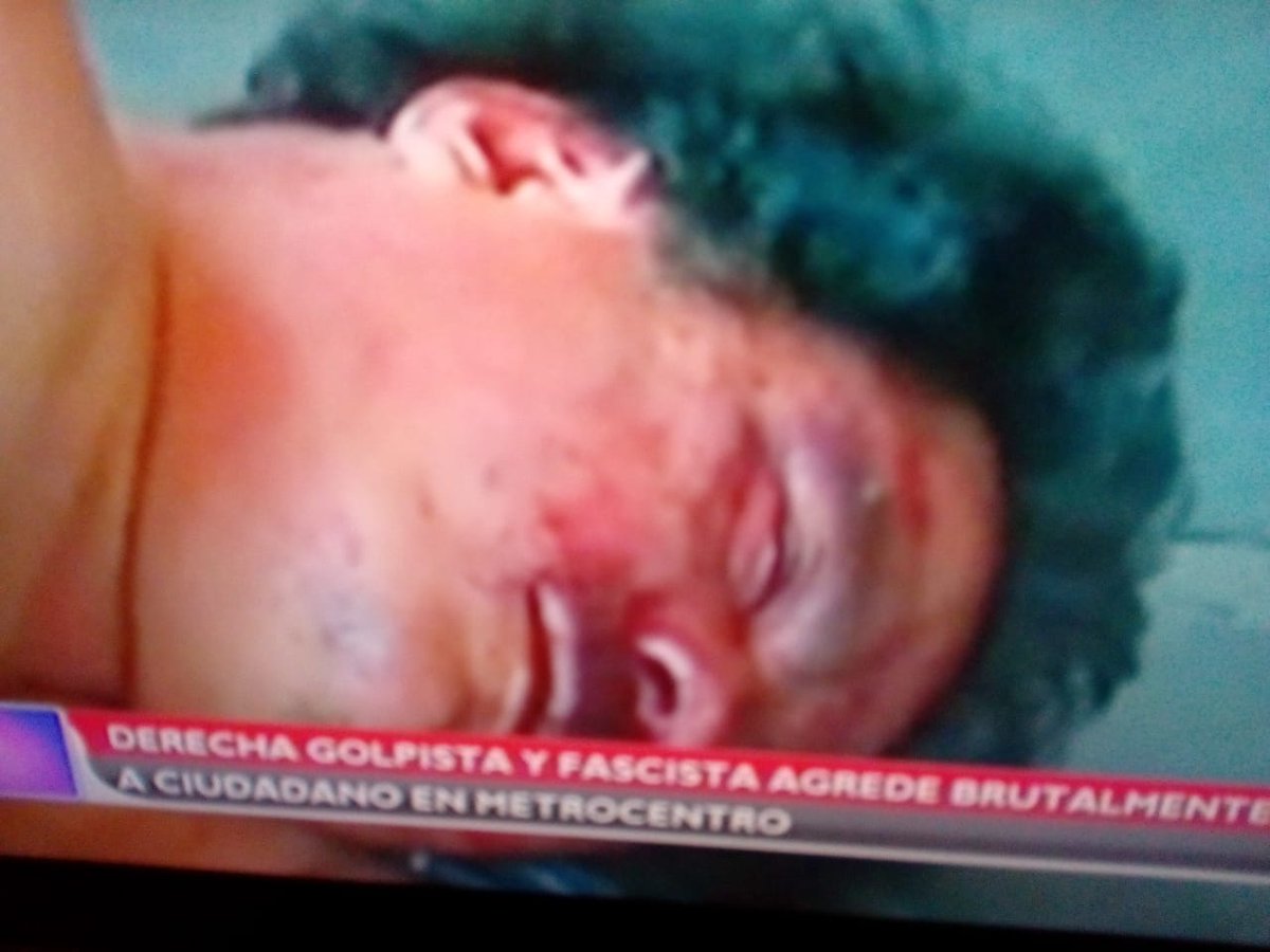 turberajs's tweet photo. A ver sera la gente tan ignorante como para ver que esos tiros no han sido disparados? Quieren buscar como seguir manipulando a la gente y justificar sus agresiones #Nicaragua40Revolución #Nicaragua #NicaraguaQuierePaz https://t.co/l7OftajYxy