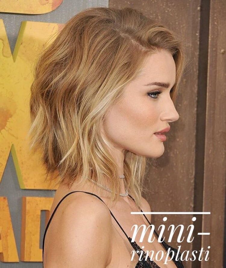 Burun ucunun geniş, asimetrik, burun ucu kıkırdaklarının birbirinden ayrı durduğu durumlarda ya da burun ucu eğriliklerinde Mini-Rinoplasti uygulamasıyla 10-15 dakika gibi kısa sürede çözüme ulaşılması mümkündür.✨✨
#serdarborabayraktaroglu #clinicsbb #rinoplasti #burunestetiği