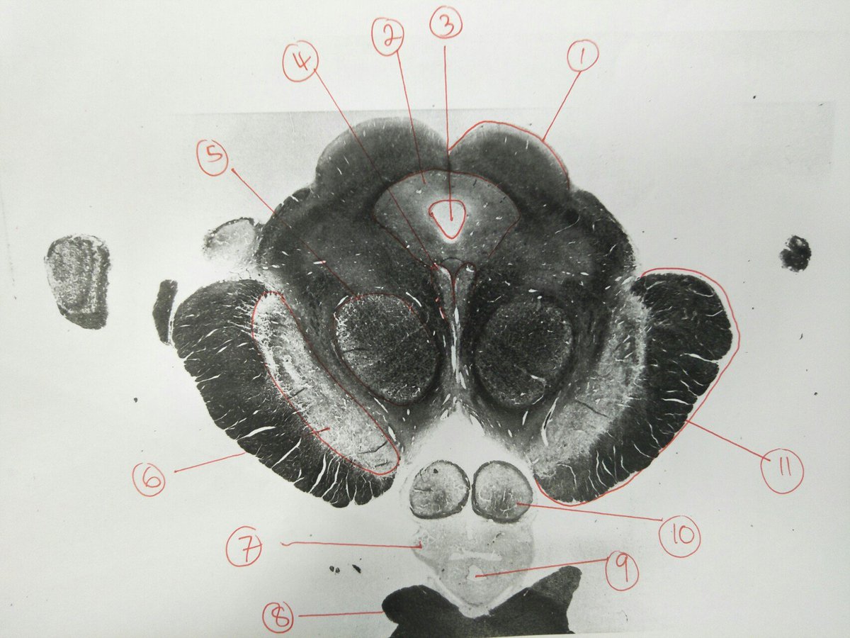 amandameyerphd's tweet photo. I set a difficult challenge for the #ANHB2217 #neuroanatomy students to stretch their #brainstem knowledge.  Great energy in the lab today!  :) https://t.co/2WXvCrRq9F