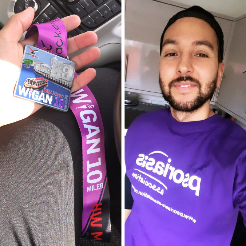 PsoriasisUK's tweet photo. Here's our fantastic fundraiser, Andrew, with his medal after completing Sunday's @Wigan10Miler! Including Gift Aid he's managed to raise almost £300 to help support our work - a brilliant effort! Thanks Andrew! https://t.co/DtvIs0l8YH #psoriasis #fundraising https://t.co/IOdiflCxbB
