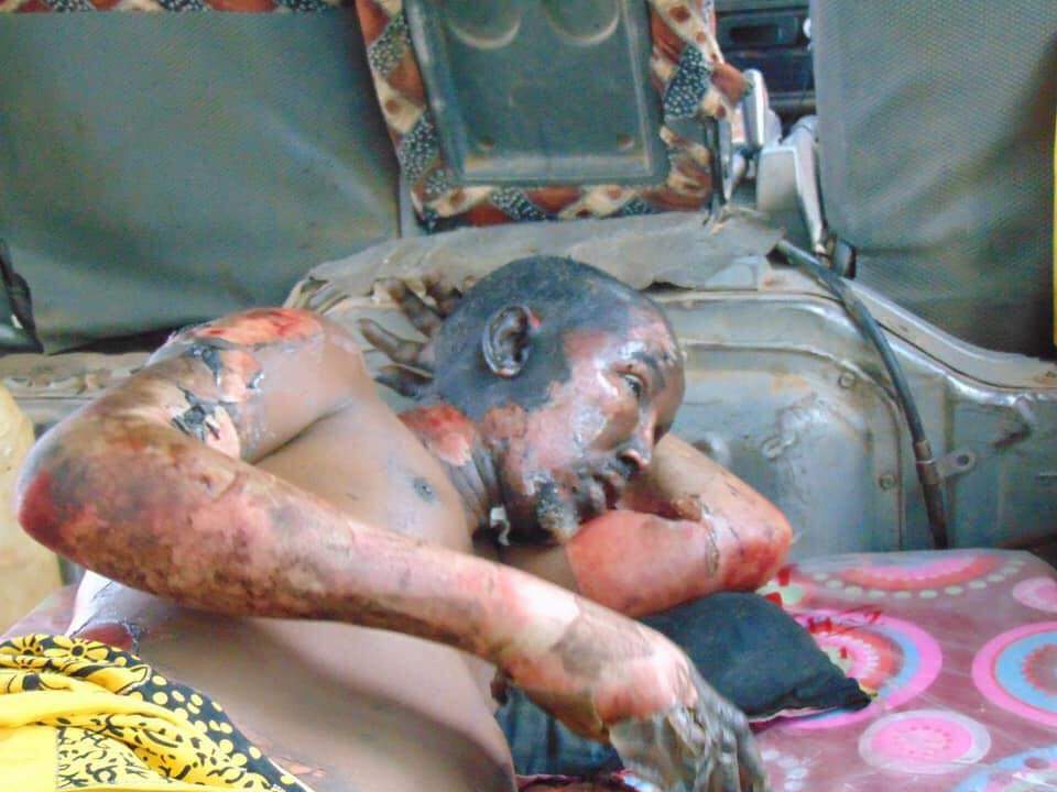 Rights_Guard's tweet photo. #BREAKING: This victim is among civilians who were injured in a U.S. airstrike in the vicinity of #Awdhegle,a small town in #Lower_Shabelle region last night. Scores are feared to succumb in the strike. The press release said, they killed three al-shabaab.#Somalia https://t.co/bjZxWx1DZx