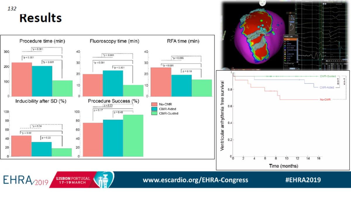 escardio's tweet image. #EHRA2019 - #Vtach Ablation highlights by Prof Antonio Burruezo

#EHRA_ESC #EPeeps #CardioTwitter