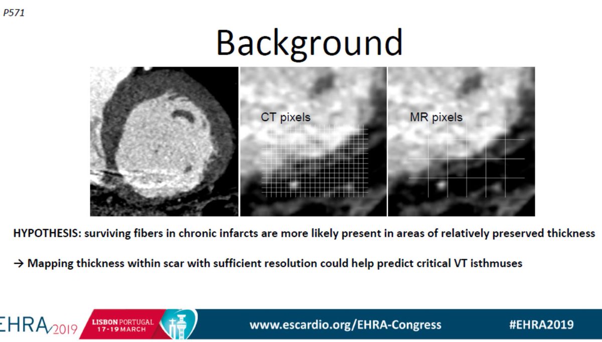 escardio's tweet image. #EHRA2019 - #Vtach Ablation highlights by Prof Antonio Burruezo

#EHRA_ESC #EPeeps #CardioTwitter