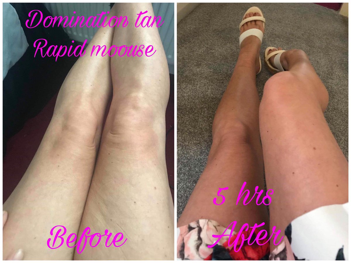 vickyg2009's tweet photo. Who wants tan results like these !!! #faketan #tan #brown https://t.co/3snaUDXsCK