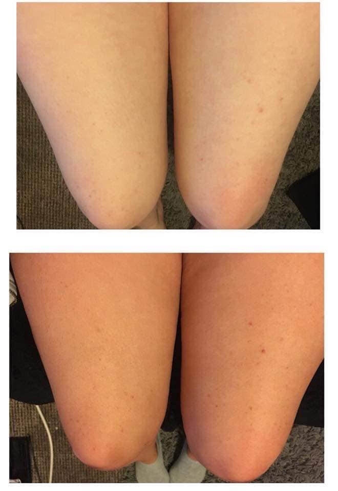 vickyg2009's tweet photo. Who wants tan results like these !!! #faketan #tan #brown https://t.co/3snaUDXsCK