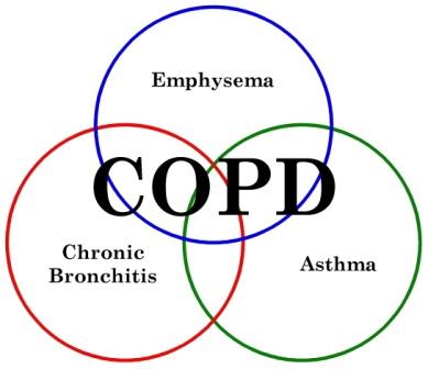 CBDintheUK's tweet photo. Request your Free Copy of "10 Great Exercises for People with COPD" - https://t.co/4ZekOu4g8v - #fibrofighter #fibrowarrior #spoonies #depression #spoonielife #fibro #health #warrior #nursingschool #pulmonarydoctor #medschool #bhfyp #spoonie #copd #emphysema #bronchitis #chronic https://t.co/kcRYMU8NGE