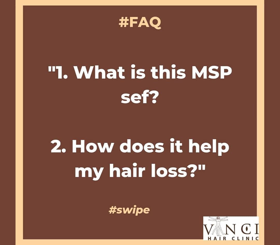 VinciHairNG's tweet image. Six things you&apos;ve always wanted to know about Micro Scalp Pigmentation (MSP), and why you probably need it. #issathread 

#MSP #microscalppigmentation #myhairlossstory #hairloss #losingmyedges #naturalhair #vincihairclinic #vincinigeria