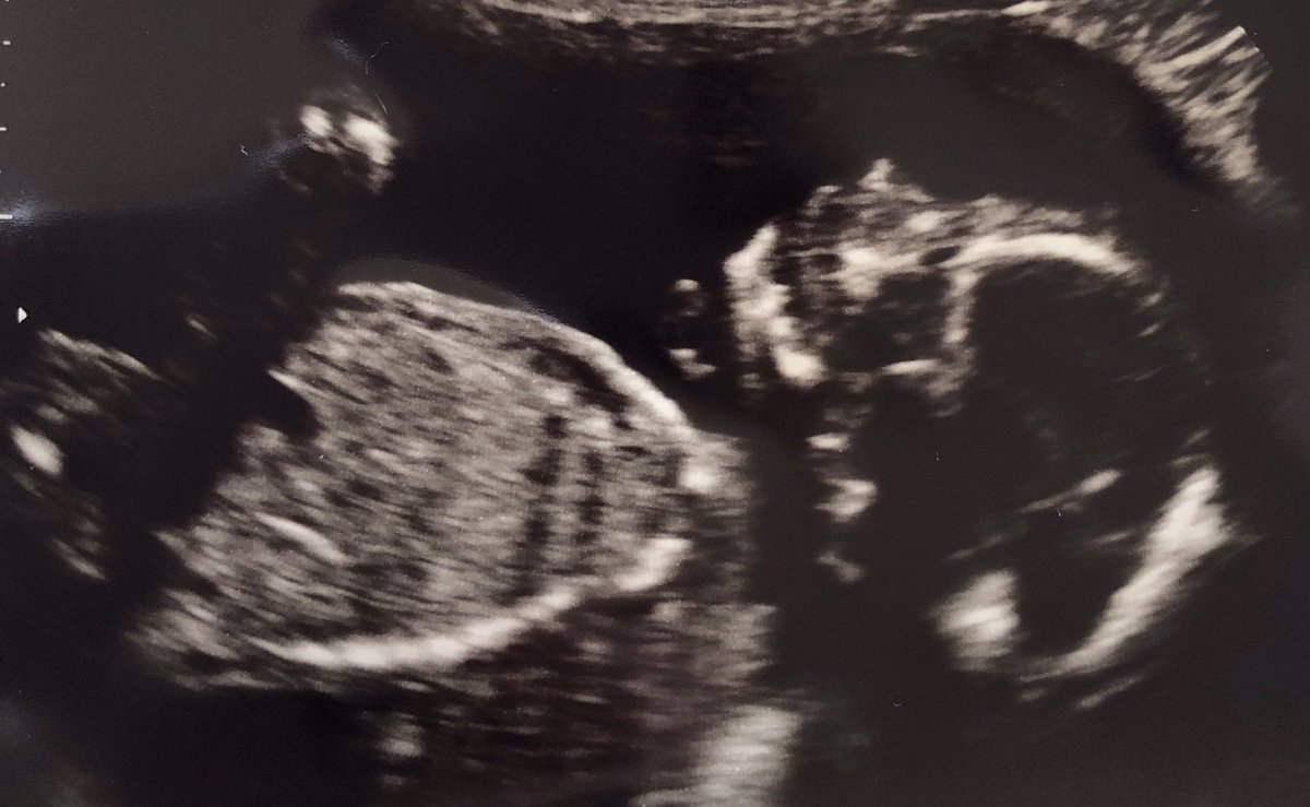 Michael Haar tweet media