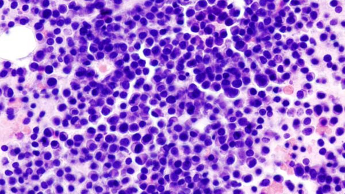 Cancer Research UK tweet media