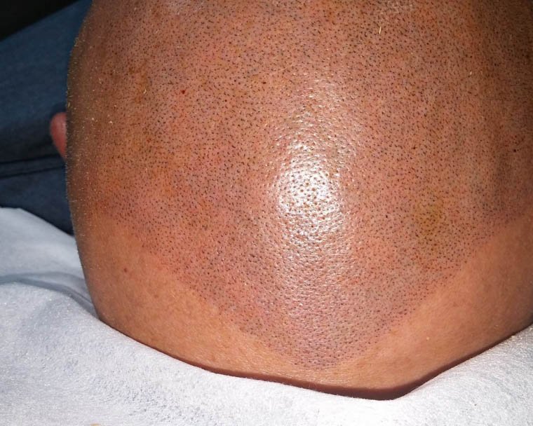 HEADLINERink's tweet photo. #Lastminutedecisions are stressful, read up on our #services such as ##ScalpMicropigmentation, #Tricopigmentation, #HairFollicleReplication and more so you know who to call when you need it. Give Us A Call at # (714) 800-9002 today! #ScalpTattooService ... https://t.co/2FHuesIQCh https://t.co/qs83hzFrYP