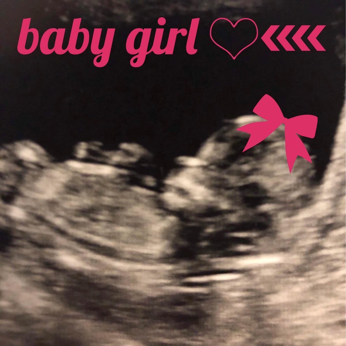 jmarinelli613's tweet photo. It’s a girl!! https://t.co/DinMYvYYYZ