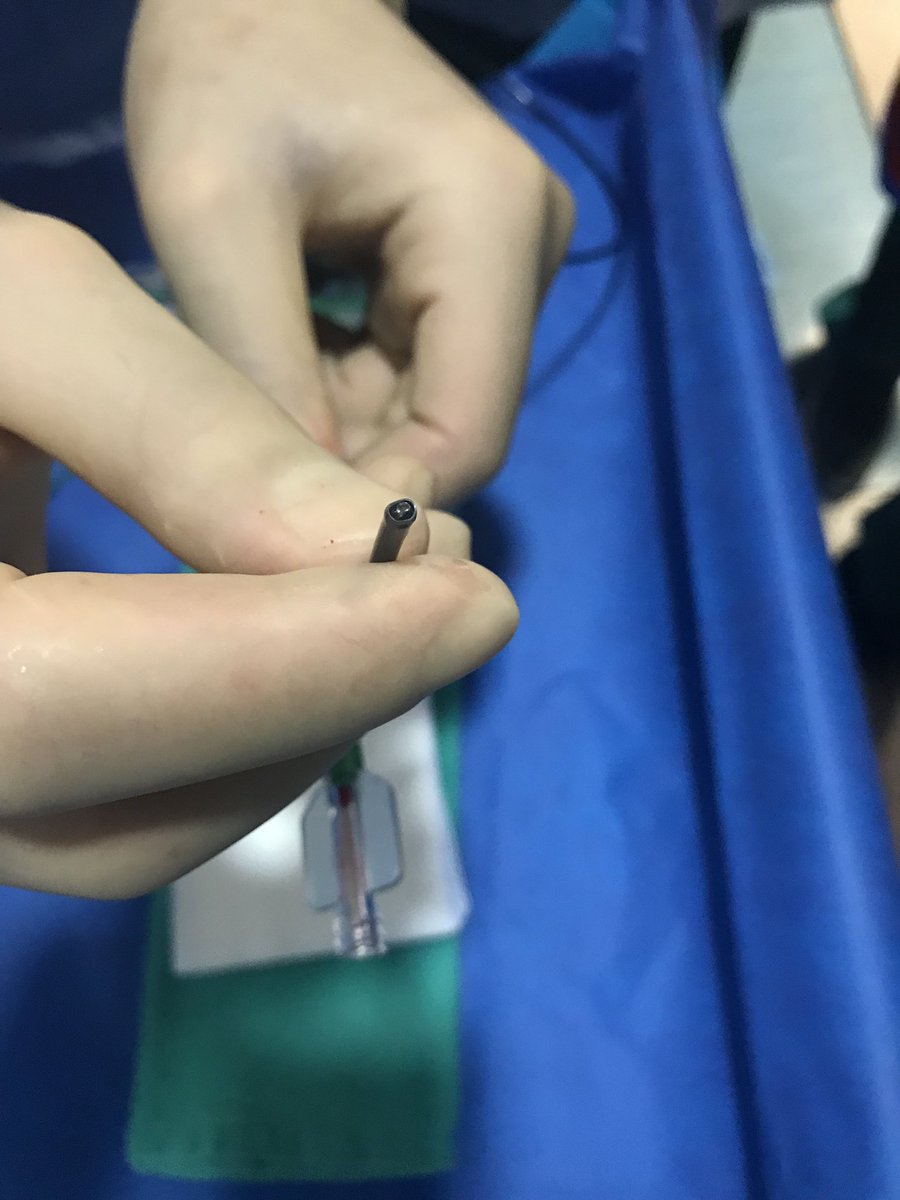 AmeerEHassan's tweet photo. What a day to be on call! My first attempt at removing shotgun pellets from a basilar artery!! REACT71  kissed it &amp; turned on suction w/a slow pull 😳. #nobulletleftbehind I’ll upload the fluoro next @svinsociety @snisinfo @esmintsociety #stroke #noELVOleftbehind https://t.co/Mq83FxxbAt