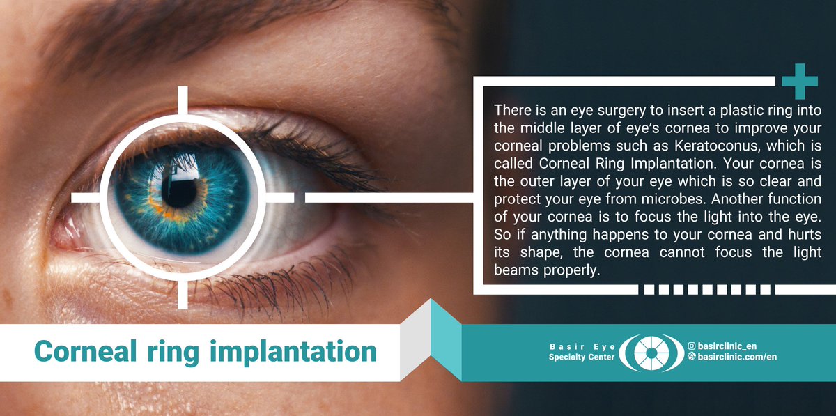 Basirclinic's tweet photo. For more information about this surgery and free consultation, CLICK to the link below!
https://t.co/T3l5RRyEhU
We save your sight.
#cornea
.

#eye #ophthalmology #basireyeclinic #LASEK #medicaltourism https://t.co/Ut3HBgLZYd