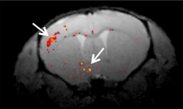 Lisade00573667's tweet photo. Web: https://t.co/Fcl9ctEO08
Eye drops deliver gene therapy for brain disorders-significant reduction in brain atrophy, neurological deficits and death in the mice #VeterinaryEpidemiology #CamelScience #Animalwelfare #VeterinaryToxicology #VeterinarySurgery #VeterinaryRadiology https://t.co/OLuGMaLDoP