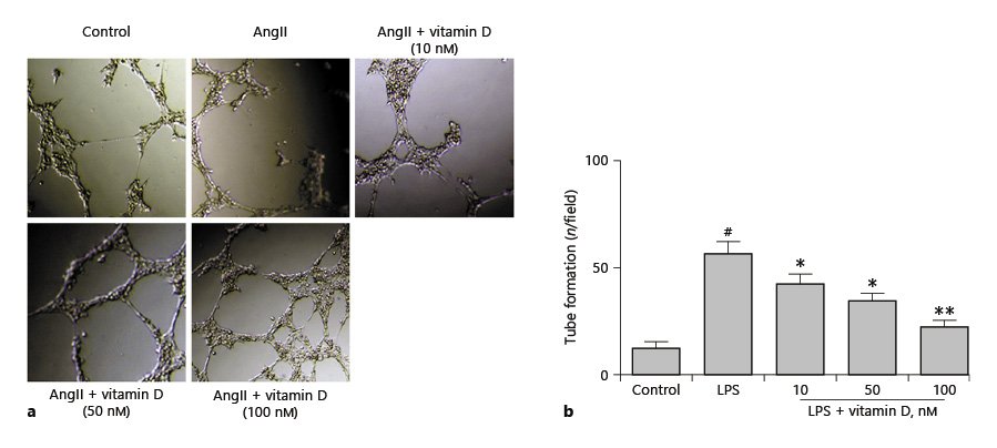 Vitamin D Ameliorates Angiotensin II Induced Human Endothelial Progenitor
Cell Injury via the PPAR-γ/HO-1 Pathway
👨‍⚕️Wei Xu
📰karger.com/Article/FullTe… #VitaminD #PPAR #VascularInjury