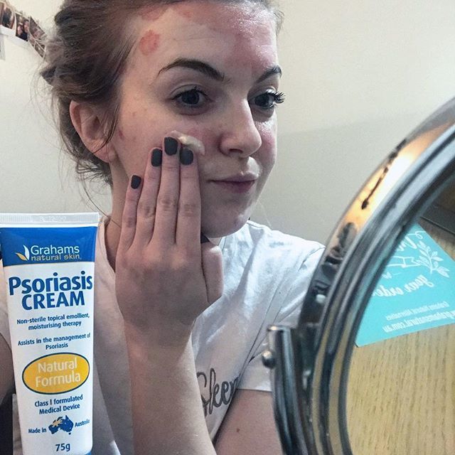 Grahams Természetes Psoriasis & Dermatitis krémvizsgálat