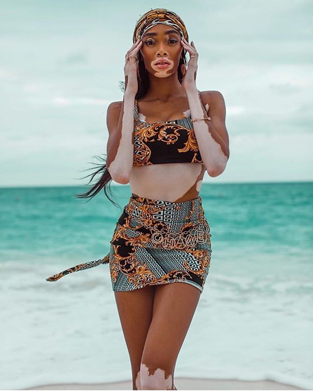 TSStandard's tweet photo. Nothing serious. Just @winnieharlow looking stunning per usual. https://t.co/FZCwmI4Zsr https://t.co/aI3TyievES