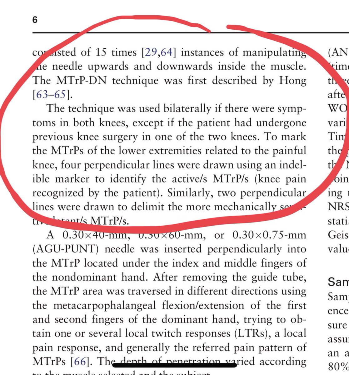 DrDunning's tweet photo. New 2019 trial finds TRIGGER POINT dry needling (pricking muscle knots with pistoning for LTRs) is NOT effective for knee OA. Perhaps try targeting the degenerative/pathoanatomic lesion in knee OA — the cartilage, periosteum, synovial fluid &amp; periarticular blood flow  @PaulBliton https://t.co/hEO1oDUNI2