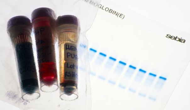 BBCSport's tweet image. At least 21 athletes across five sports are suspected of having blood-doping links to a German doctor at the centre of an ongoing investigation.

bbc.in/2Fg5mlr