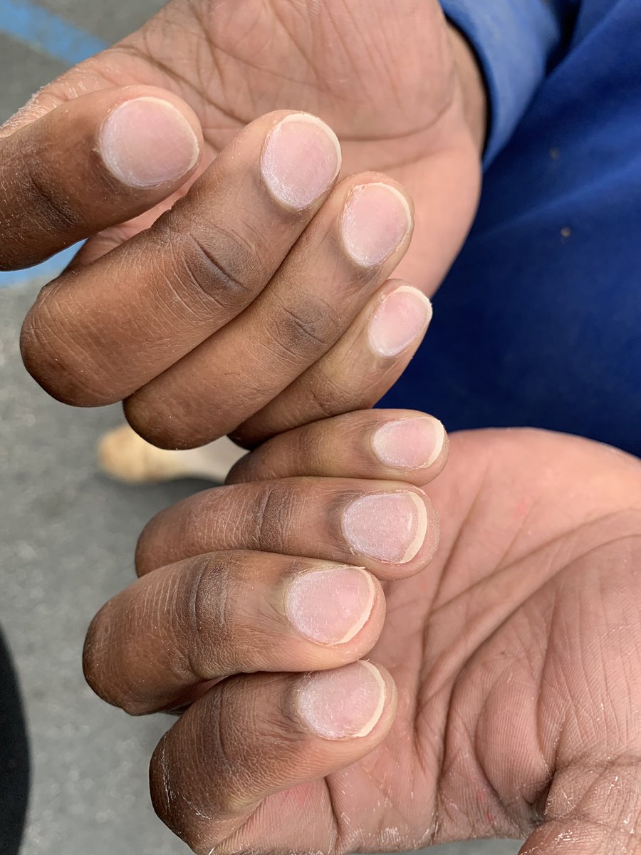 NailGalore4Sure's tweet photo. Didn’t have a nail model so my fiancé stepped up 💪🏽😍 I soaked his nails off RIGHT AFTER. https://t.co/0FsZKJibQe