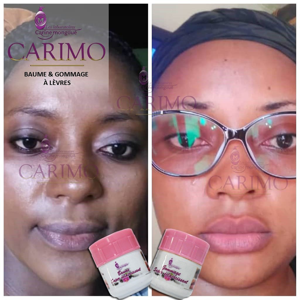 labocarimo's tweet photo. Rayonnez d'éclat avec les produits CARIMO et laissez votre entourage vous inonder de compliments.
Chez CARIMO chacun trouve son compte
Cliente satisfaite du Duo Baume &amp; Gommage à lèvre by CARIMO.
Prix : 10 000 Fcfa 
CARIMO,l'audace d'être soi!
#LCM #CARIMO #GETADDICTED https://t.co/9S8l4h1Ra0