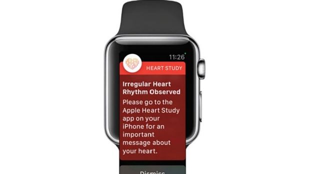 Een mooi voorbeeld van virtuele zorg waar wetenschappelijk onderzoek naar is gedaan. Lees de vroege resultaten van Stanford University en het artikel over de inzet van een smartwatch in Nederland. 
Stanford: buff.ly/2TMD1wt
NAAST experimenteert: buff.ly/2JnQG9c