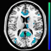 IASPpain's tweet photo. From the IASP Pain Research Forum: How the Brain Distinguishes Different Types of #Touch: A new study in healthy volunteers shows significant differences in brain processing of self-produced versus other-touch. https://t.co/Rm00g4H8JO  @kaytsukel https://t.co/p3NUAXZUGJ