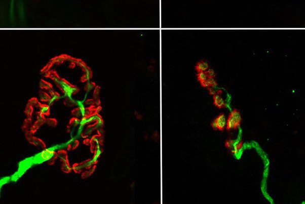 WomenDoingSci's tweet photo. Innes (@ines_boehm) is a PhD student at @EdinburghUni studying neuromuscular junctions (NMJs), the synapses within our muscles. Ines primarily works with human tissue but also works with mammalian species. 

#WomenDoingScience https://t.co/LCElscDL5S
