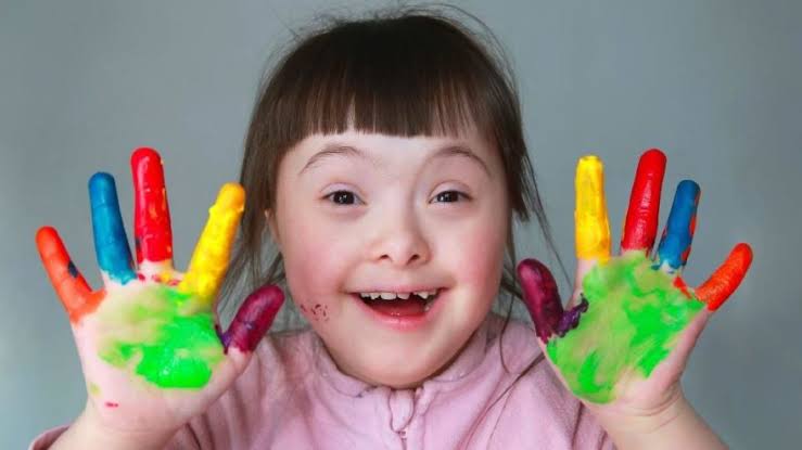 Tıpkı sizin gibiyiz +1 fazla #DownSendromu