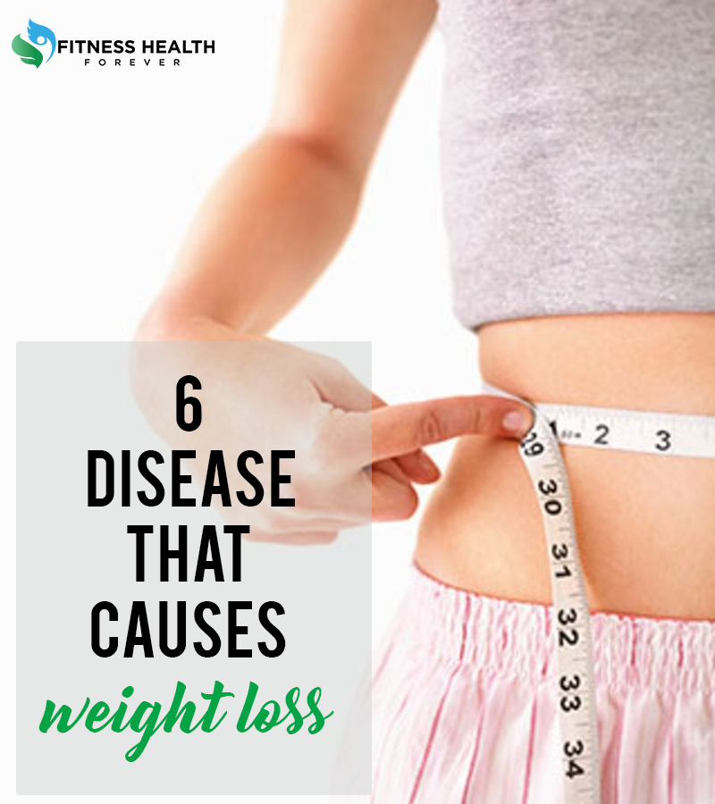 FitnessHealthF1's tweet photo. Weight Loss has many different reasons. some reasons are Normal and easy to be handled by changing your Eating Lifestyle.
visit:https://t.co/bHTtQWVMlm

 #HealthyLifestyle #Fitness #Exercises #Stayfit https://t.co/5L8bBQwLVd