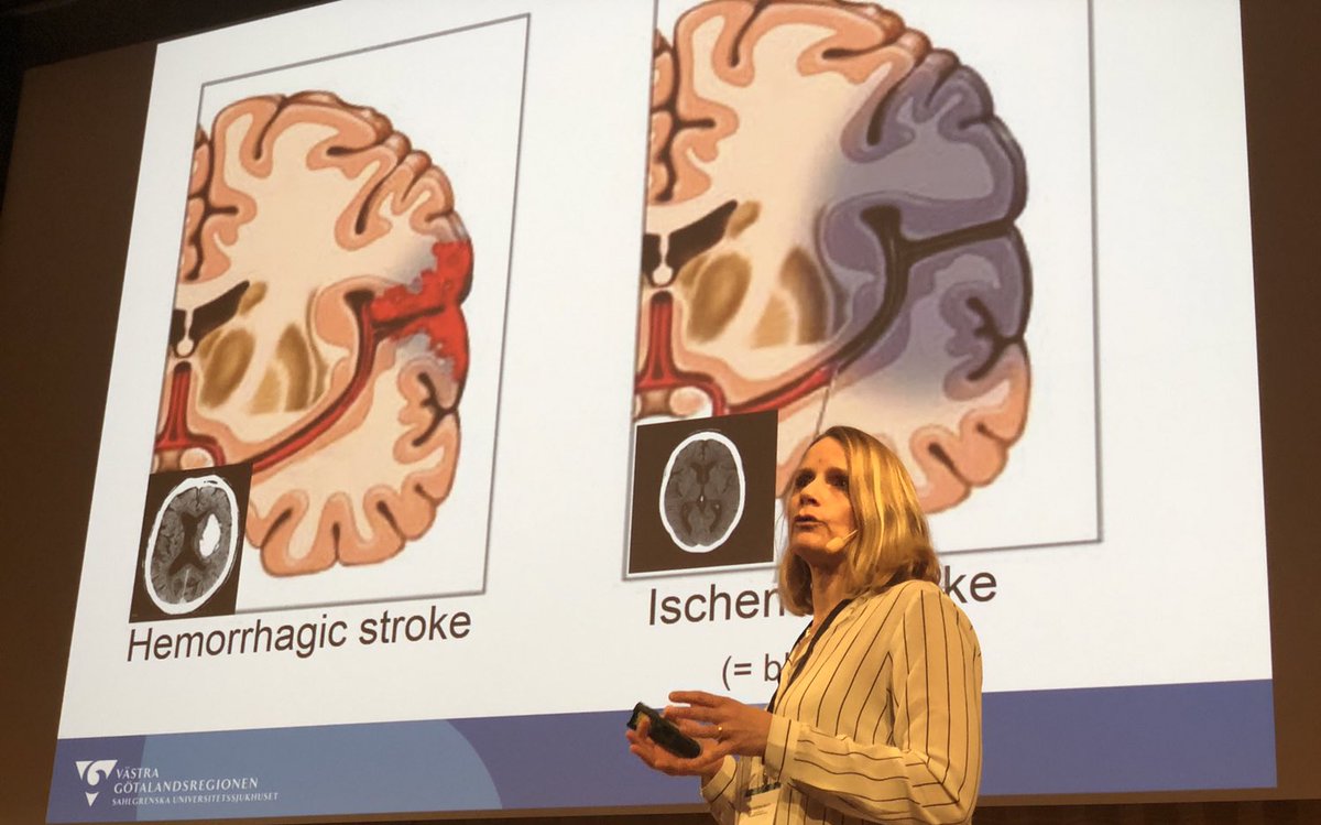 EngineeringHea1's tweet photo. Using Video support to improve stroke diagnosis in the ambulance presented by Stefan Candefjord, @chalmersnyheter and Annika Nordanstig @goteborgsuni @sahlgrenska at #engineeringhealth 2019 https://t.co/P7uZncUei7