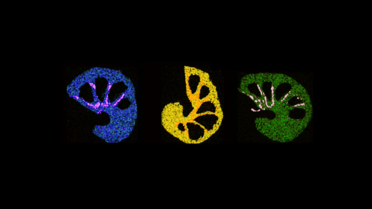 CAGE_COE's tweet photo. The March Photo of the Month is now being featured on the new @CAGE_COE website! Congrats to Chiara Borrelli and Giuliana Panieri for submitting the winning photo! #foraminifera #paleoclimate #paleooceanography @UiTromso @geoforskning @scireports
https://t.co/rzhp6Bi6AD https://t.co/DDMZcsSfOh