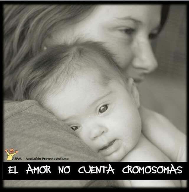 sadetvalera's tweet photo. #21DeMarzo #DiaMundialdelSindromedeDown https://t.co/cXrpQqLIU8