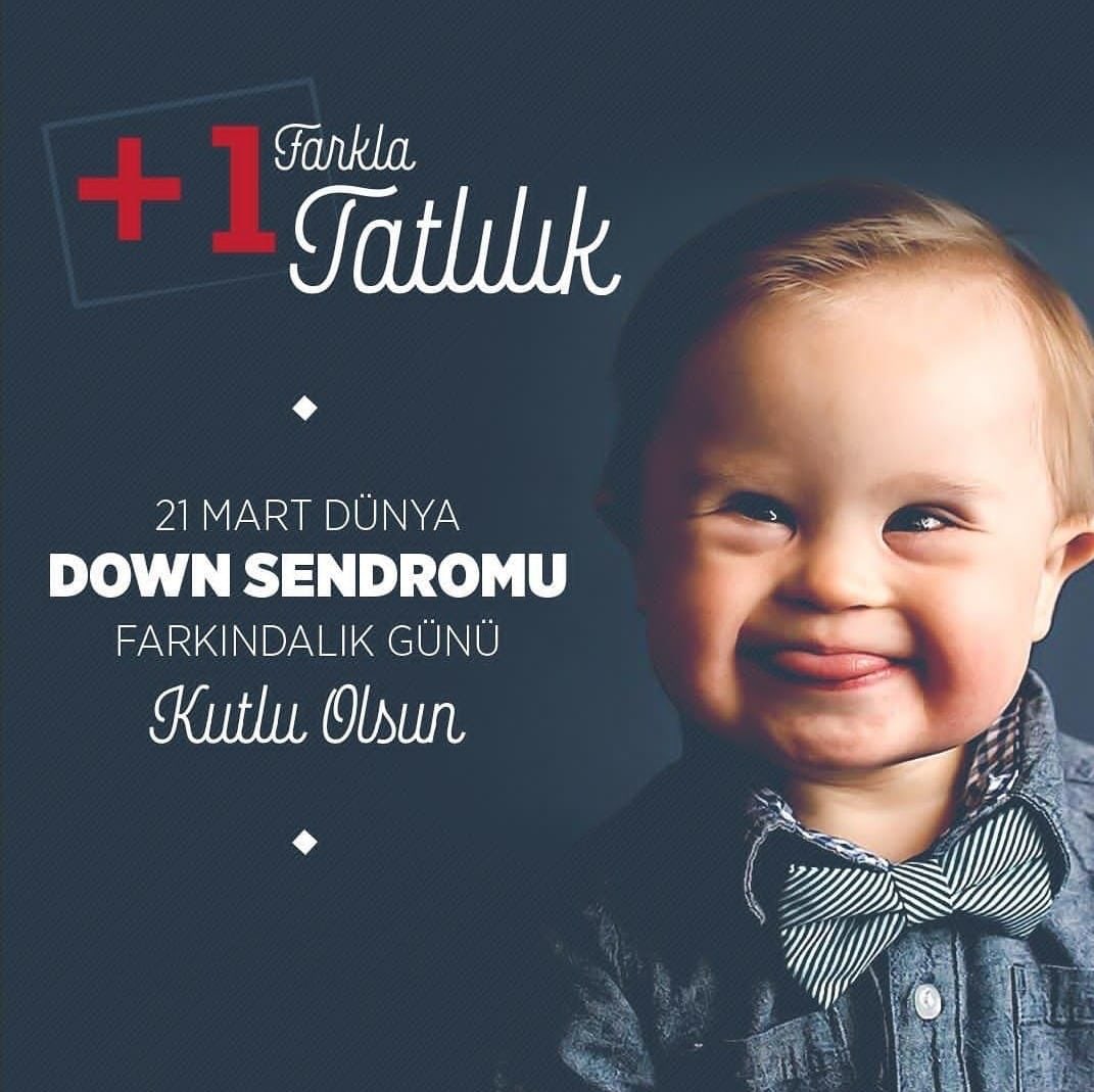 Gerçek dostlar kromozom saymaz, Down sendromu 1 eksiklik değil +1 fazlalıktır