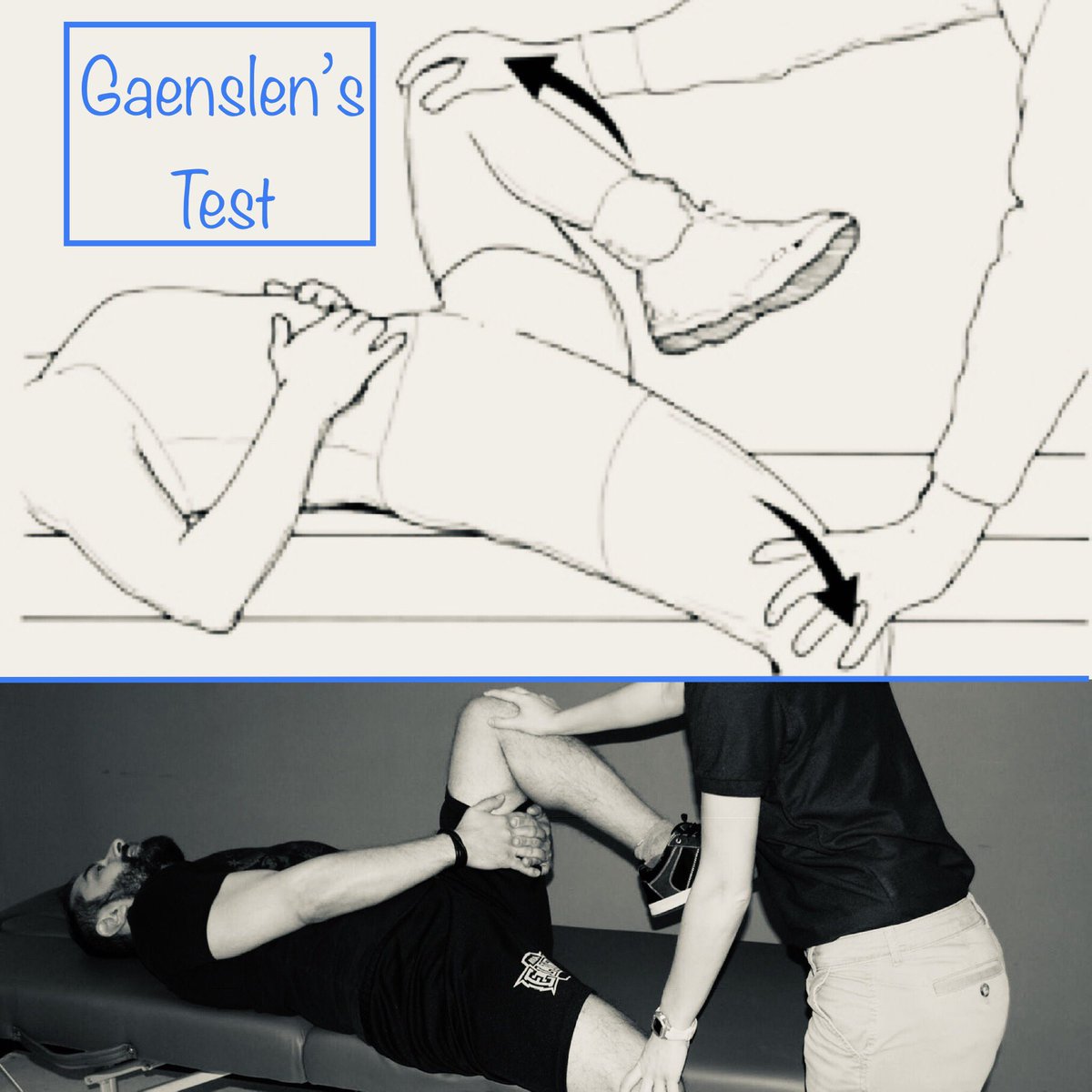 peds_sports_med's tweet photo. Gaenslen's test: detects lumbar vert and more so SI joint pathology. The manuever stress both SI joints equally. Used to assess for sacroilitis, SI dysfunction, spondyloarthritis, sciatica, or other forms of rheumatism. #sportsmedicine #SIpain #physicalexamskill #lowbackpain https://t.co/9DpMsI1a4S