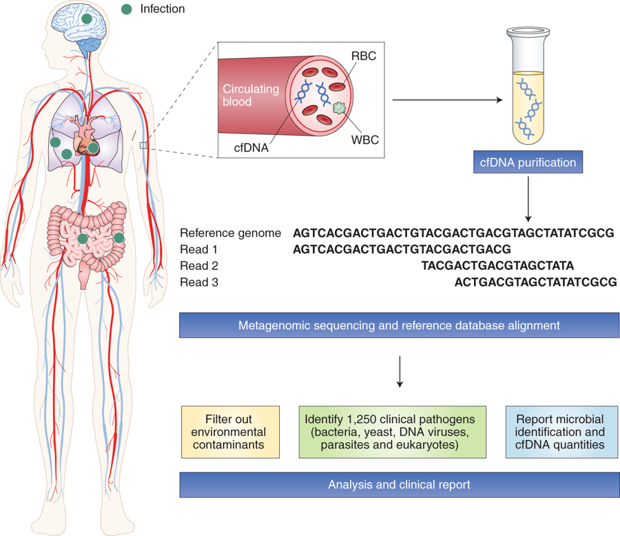 News &amp; Views by <a href="/Justin_OGrady/">Justin O'Grady</a> on metagenomic-based clinical diagnosis of infection: rdcu.be/br9y0

Linked to Blauwkamp et al.: rdcu.be/br9zB
