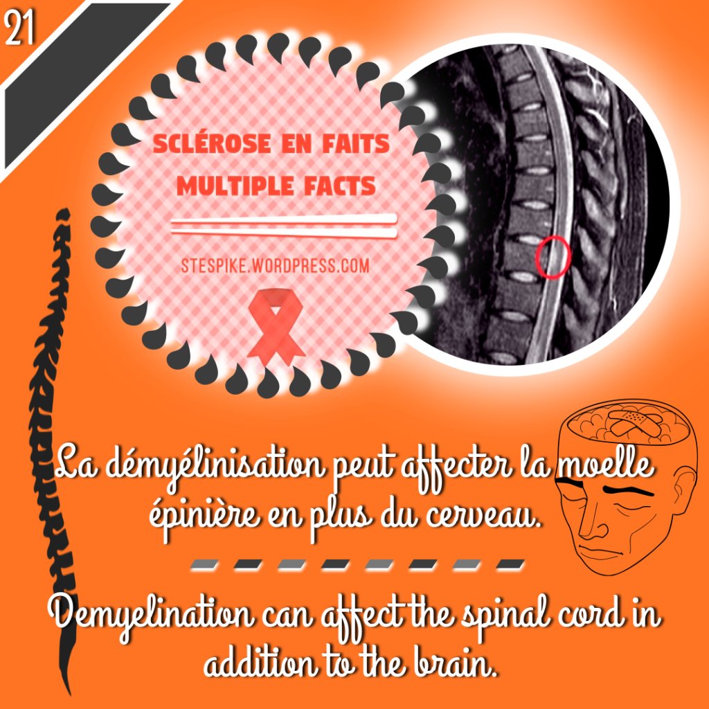 stespike17's tweet photo. Fait #21 Fact
#Scleroseenfaits #multiplefacts #Thisisms #StopSP #SEP #Sensibilisation #Awareness #Spoonie #Wordpress #MS https://t.co/WKJ2fCUSpQ https://t.co/B8Kek9mSJE
