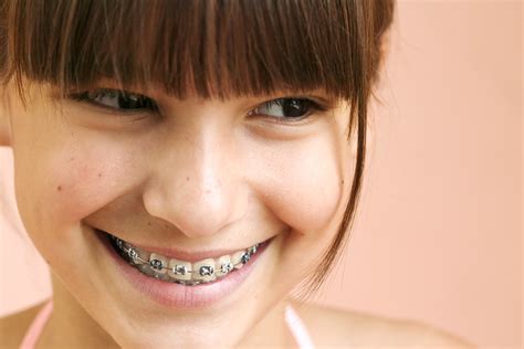 AliciaDentistry's tweet photo. Whether it’s traditional braces or custom made removable appliances, #orthodontics can help you have the healthy, straight, beautiful #smile you’ve been waiting for! Give us a call today and schedule your orthodontic consultation! 
(949) 586-9800 https://t.co/MTlAefIH3n
