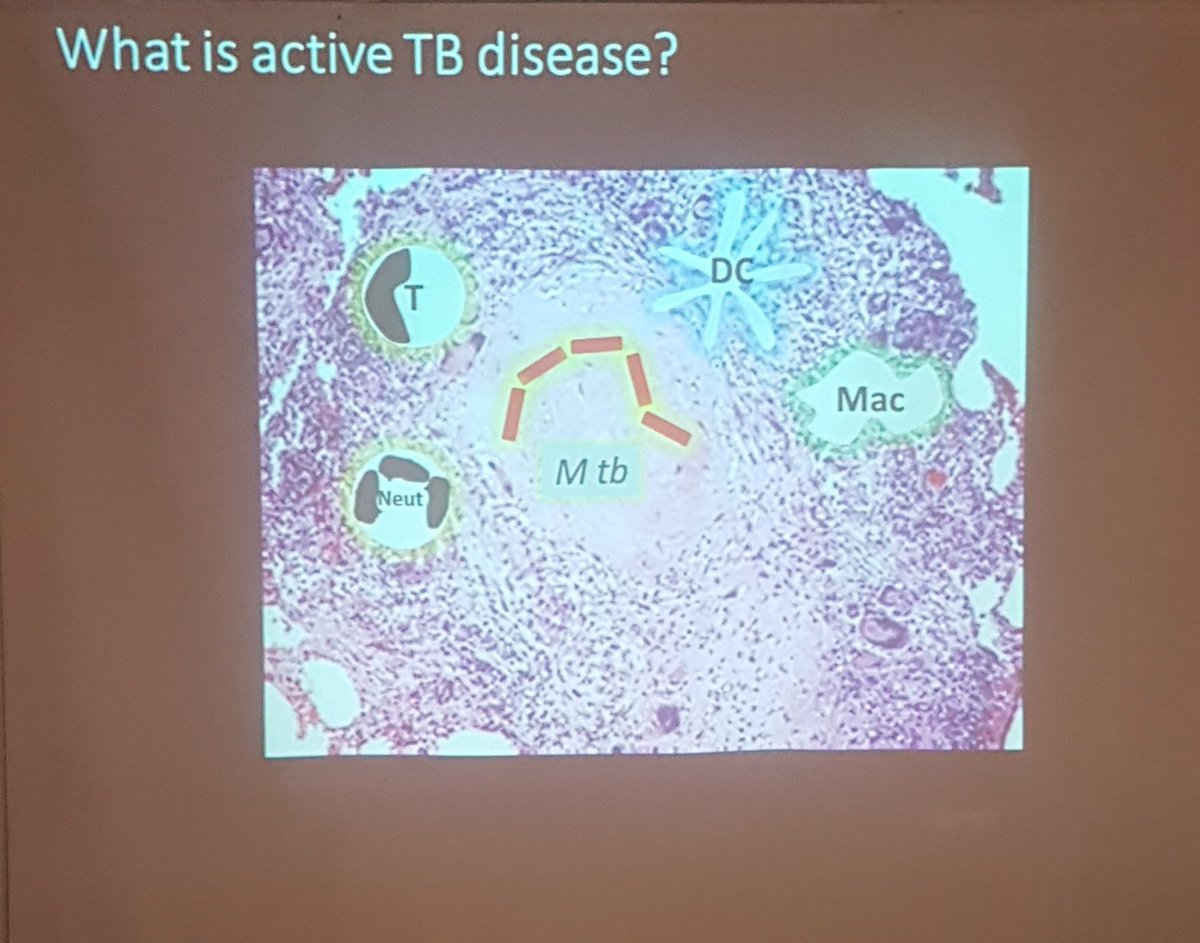 The HTD (@htropdis) on Twitter photo Excellent grand round <a href="/HTropDis/">The HTD</a> from <a href="/gpollara/">Gabriele Pollara</a> on what causes pathology in Tuberculosis. <a href="/HTropDis/">The HTD</a> we contribute to the North London TB Service bit.ly/2FsRBBa based <a href="/WhitHealth/">Whittington Health NHS Trust</a> where patients concerned they may have TB can be seen at one of our walk-in clinic Excellent grand round <a href="/HTropDis/">The HTD</a> from <a href="/gpollara/">Gabriele Pollara</a> on what causes pathology in Tuberculosis. <a href="/HTropDis/">The HTD</a> we contribute to the North London TB Service bit.ly/2FsRBBa based <a href="/WhitHealth/">Whittington Health NHS Trust</a> where patients concerned they may have TB can be seen at one of our walk-in clinic