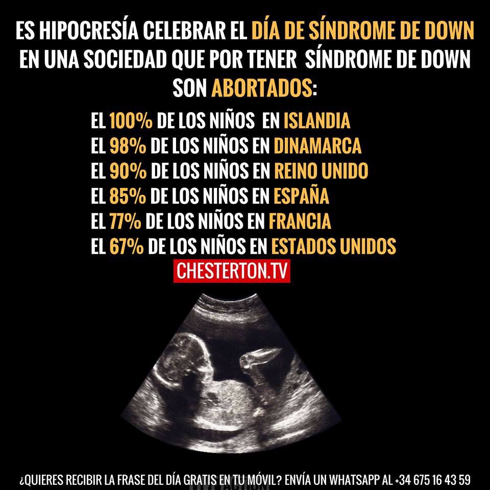 PolitologosV's tweet image. En el #DiaMundialDelSindromeDeDown los #PolitologosXLaVida expresamos nuestro rechazo a las normas que en el mundo promueven su exterminio y nos comprometemos a trabajar sin descanso para garantizar el derecho a la vida de todos los argentinos, sin exclusión

Por ellos, #YoVoy23M