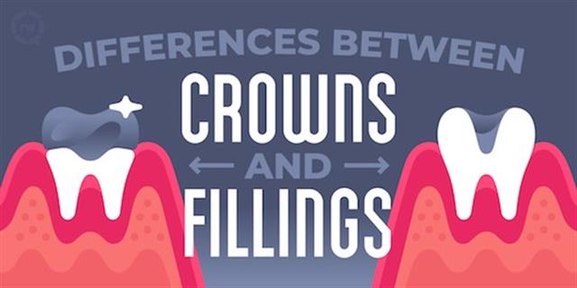 SmilesArtistic's tweet photo. Ever wonder what the difference between a crown and filling is? Let us fill you in! 😎 https://t.co/25yiCbFgGI https://t.co/SRswIZPWmt