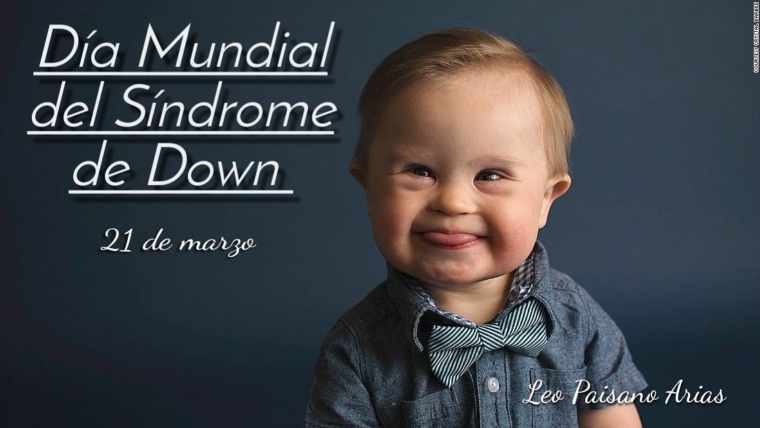 Guerreros, fuertes, valientes; quienes merecen las mismas oportunidades.
Mientras el mundo habla de guerra, ellos sólo saben de amor.
#DiaMundialdelSindromedeDown