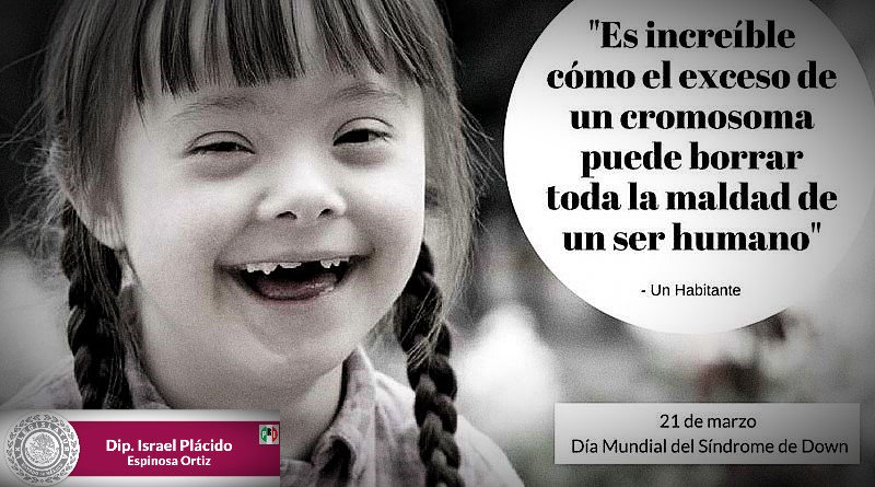 IsraelEspinosaO's tweet photo. Recorre los pasos hacia un mundo distinto: respeto, aceptación, inclusión, integración y convivencia. 👧🧒

Hoy se conmemora el Día Mundial del Síndrome de Down, designado por la Organización de las Naciones Unidas (ONU). https://t.co/DshRYOKg2c