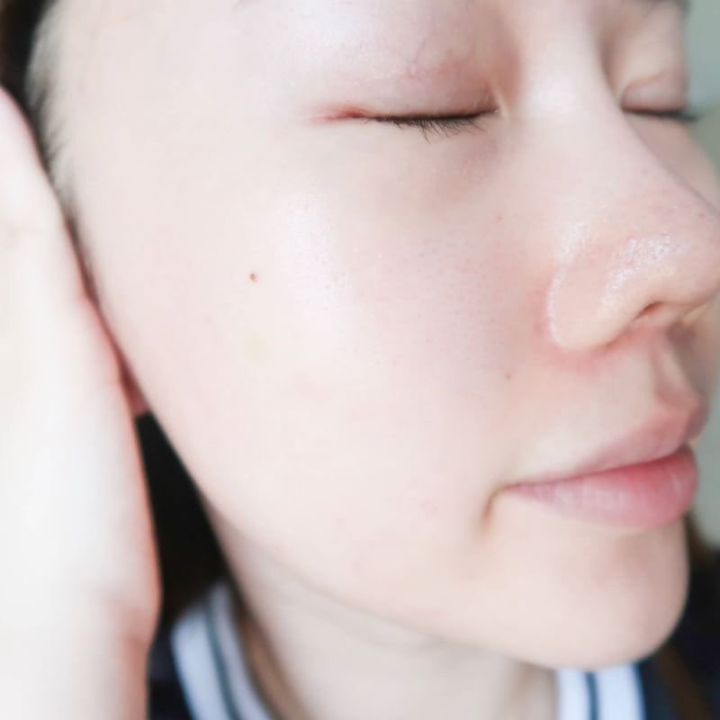 fonfondly's tweet photo. บอกเลยว่าซื้อตุนไว้แน่นๆ BK Acne Serum แบบซองไว้พกไปต่างประเทศมั่นใจว่าเป็นเซรั่มตัวเดียวที่ไม่แพ้ ช่วยบำรุงผิวไม่ให้เกิดสิวแถมให้ความชุ่มชื้นด้วย  แบบขวดพกติดบ้านไม่เคยขาด เวลาเพื่อนปรึกษาเรื่องสิวก็จะให้เอาแบบซองไปใช้ด้วย เพื่อนหลายคนติดใจก็ไปจัดแบบขวดเหมือนกัน https://t.co/v4WgWnOIbH