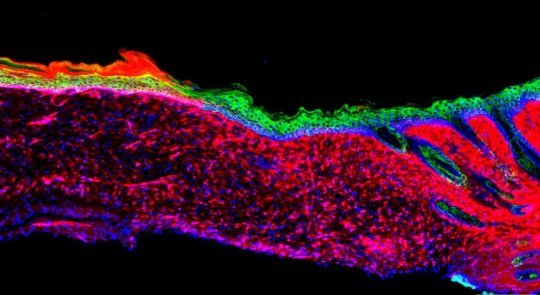 LOptics2019's tweet photo. The alchemy of healing: Researchers turn open wounds into skin https://t.co/6t17aWzNMP https://t.co/W1HTOl1Z58